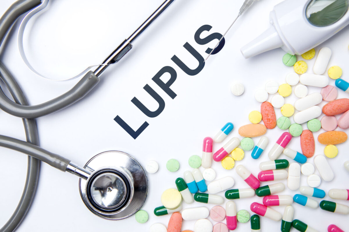 Lupus Treatment